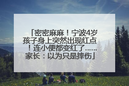 密密麻麻！宁波4岁孩子身上突然出现红点！连小便都变红了……家长：以为只是摔伤