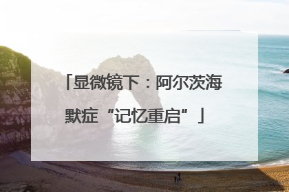 显微镜下：阿尔茨海默症“记忆重启”
