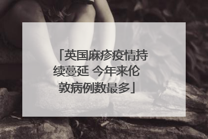 英国麻疹疫情持续蔓延 今年来伦敦病例数最多